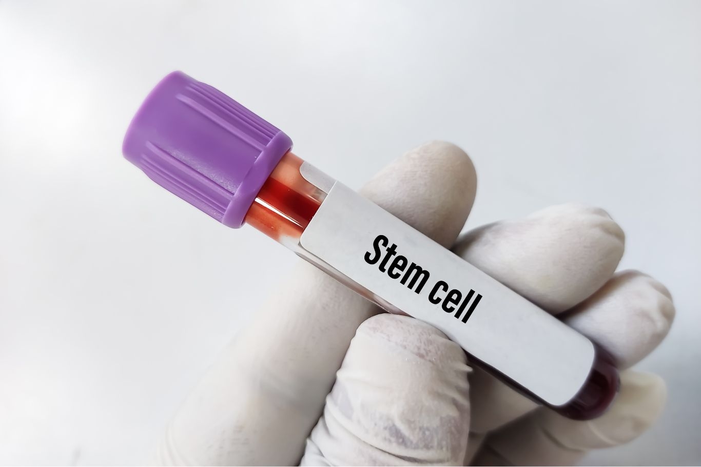 Benefits of Stem Cells: Explained